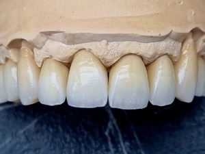 Auto entrepreneur Céramiste 