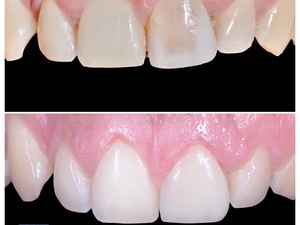 PROTHESISTE DENTAIRE H/F