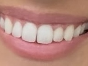 Remplacement omnipraticien 