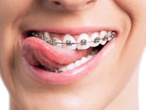 Opportunité Rare en Orthodontie H/F