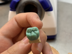 Trouver un travail en tant que prothésiste en fixe  ou adjointe 